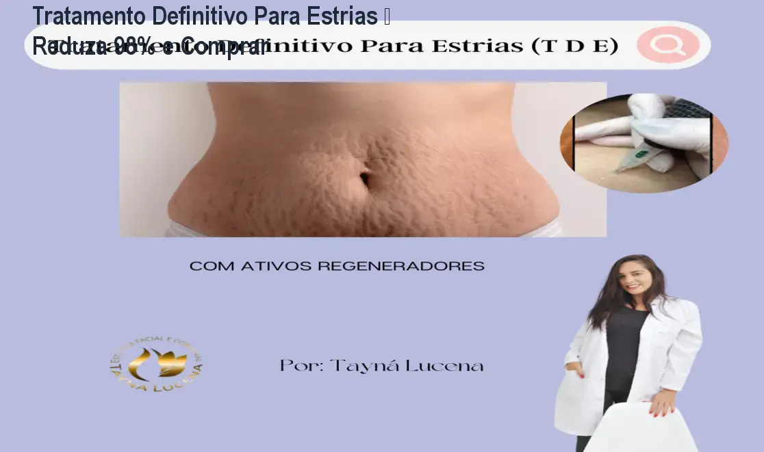 Imagem do curso Tratamento Definitivo Para Estrias mostrando técnica de regeneração dérmica que reduz estrias em até 98%