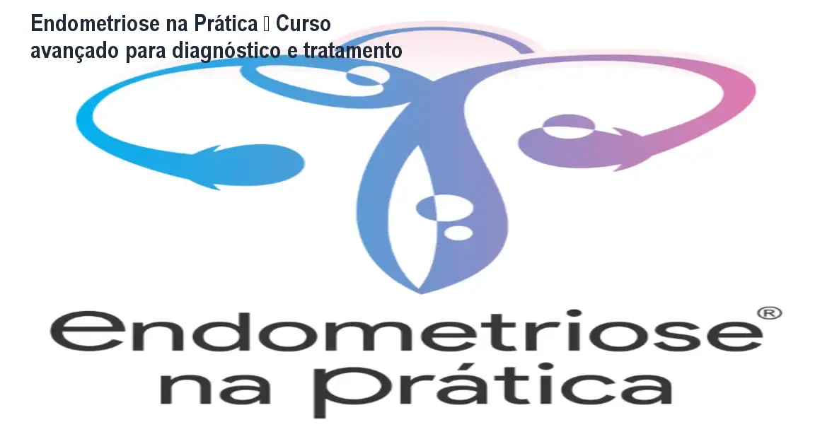 Endometriose na Prática – Curso avançado para diagnóstico e tratamento 1 https://ondeaprender.com.br/aprender/endometriose-na-pratica-download-gratis/ Endometriose na Prática – Curso avançado para diagnóstico e tratamento