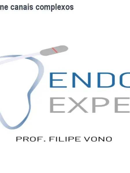 Método VONO – Domine canais complexos com kit exclusivo