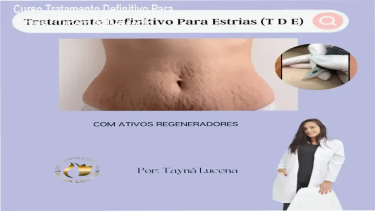 Tratamento Definitivo Para Estrias de Tayna de Lucena Silva – promoção de desconto