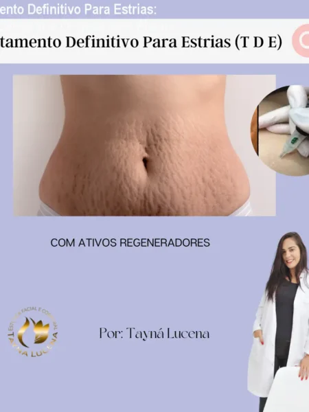 Tratamento Definitivo Para Estrias: Como Comprar o Original sem Riscos