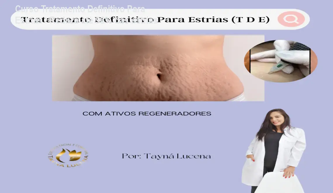 Curso Tratamento Definitivo Para Estrias – Reduza até 98% das estrias 1 https://ondeaprender.com.br/aprender/tratamento-definitivo-para-estrias-download-gratis-ou-nao/ Curso Tratamento Definitivo Para Estrias – Reduza até 98% das estrias