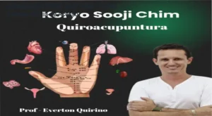 Representação visual da técnica de Quiropuntura Koryo Sooji Chim aplicada nas mãos para alívio de dores.