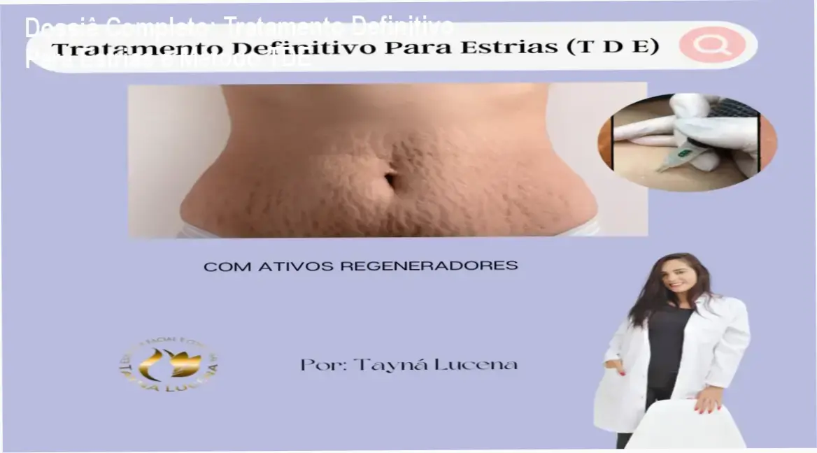 Dossiê Completo: Tratamento Definitivo Para Estrias e Método TDE 1 https://ondeaprender.com.br/tratamento-definitivo-para-estrias-metodo-tde/ Aplicação de técnica de regeneração dérmica para redução de estrias conforme método TDE